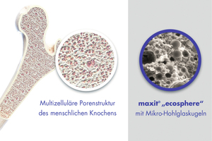  Bei der Entwicklung von Ecosphere orientierte sich Maxit am Beispiel der Natur, die Überdimensionierung stets vermeidet. So diente etwa der Aufbau menschlicher Knochen, die aus idealen, multizellulären Porenstrukturen bestehen, als Vorbild. 